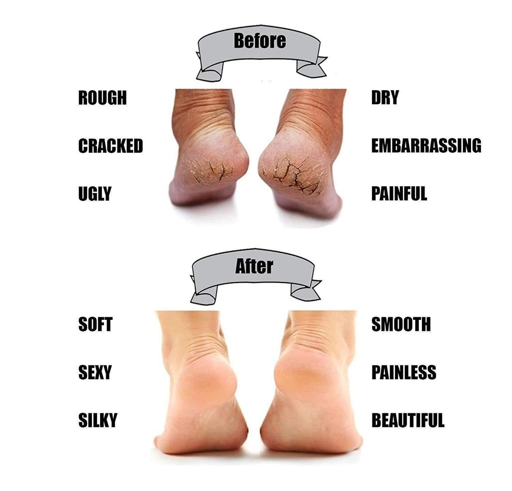 Silicon Gel Pad Heel Protector Socks